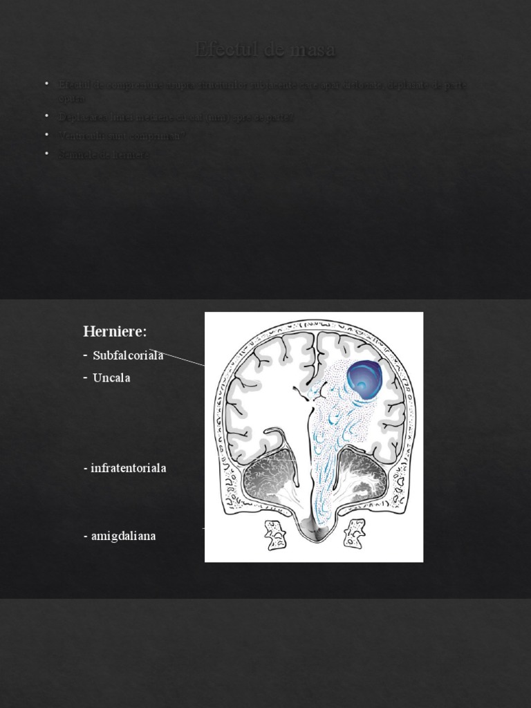 Neuro | PDF