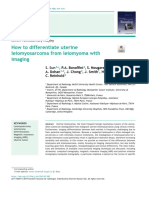 How To Differentiate Uterine Leiomyosarcoma Fro - 2019 - Diagnostic and Interven