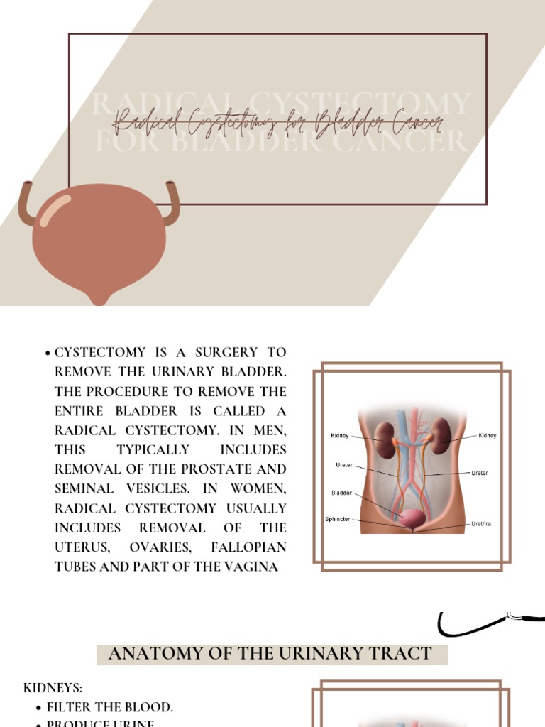Radical Cystectomy For Bladder Cancer | PDF | Urinary Bladder | Urinary ...