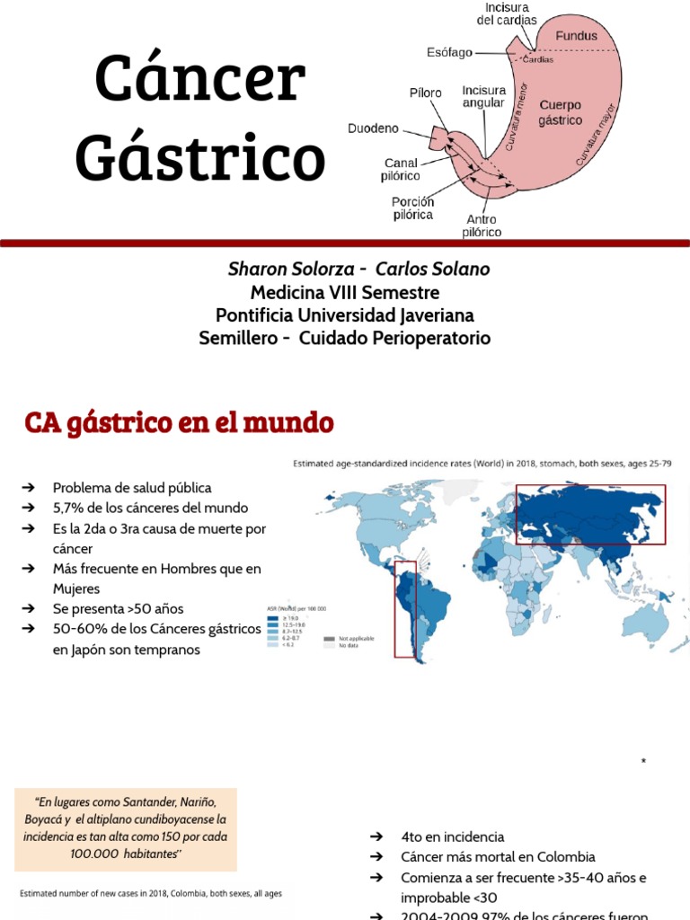 Análisis Del Cáncer Gástrico Factores De Riesgo Manifestaciones