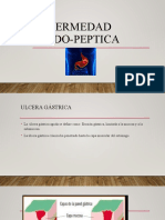 Ulcera gástrica e intestinal: factores de riesgo, complicaciones y tratamiento