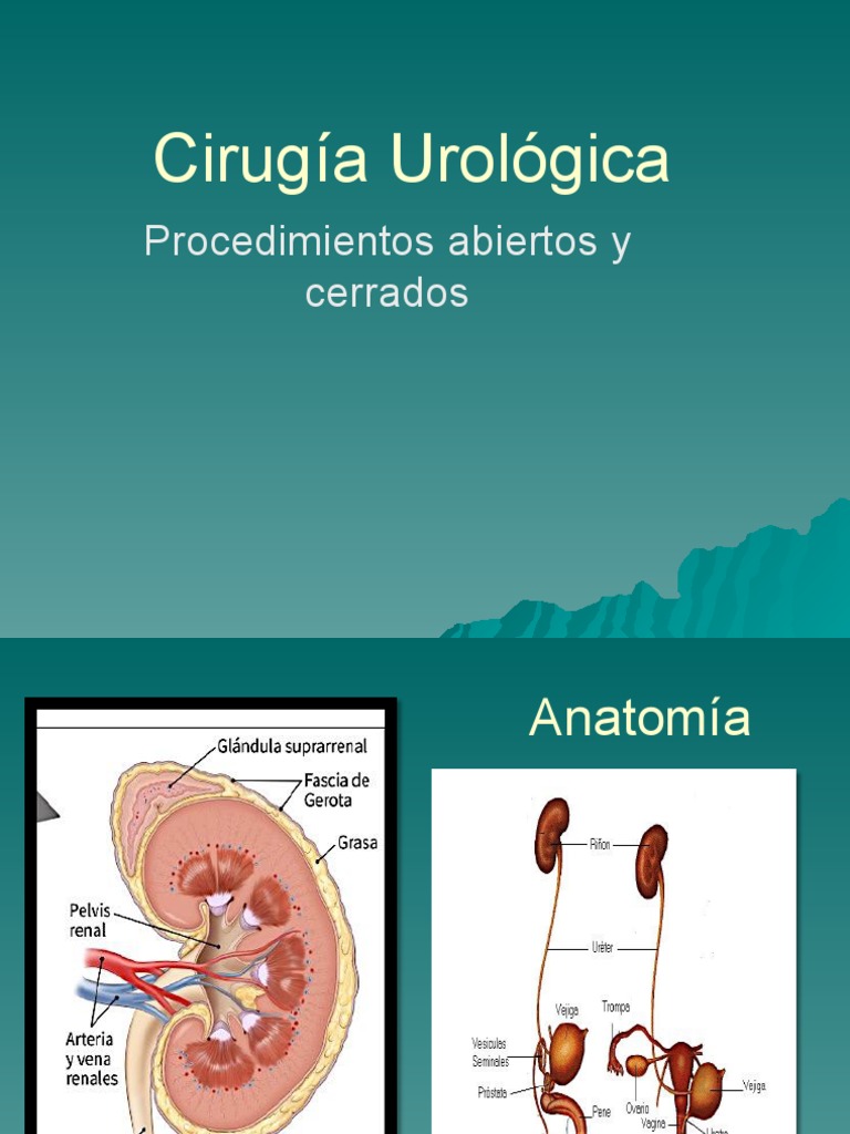 Procedimientos en Cirugía Urológica | PDF | Riñón | Vejiga urinaria