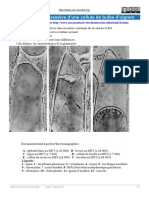 Plasmolyse Dune Cellule de Bulbe Doignon F