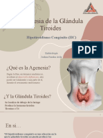 Agenesia de La Glándula Tiroides