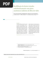 Artigo Reabilitacao de Dentes Endodonticamente Tratados Com Pinos