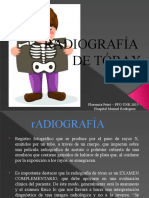 RADIOGRAFÍA