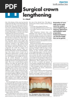 Download 11TSL Surgical Crown Lengthening by Dina Barakat SN62465036 doc pdf