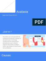 Acalasia