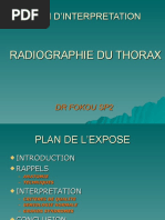 Signe de la silhouette en radiologie | PDF | Aorte | Thorax