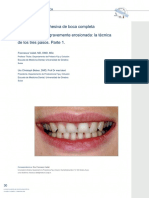 Full-Mouth Adhesive Rehabilitation of a Severely Eroded Dentition The Three-Step Technique. Part 1 (1)