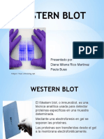 Detección de proteínas mediante Western Blot