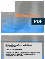 Atelectasis Radiology Report by Dr. Gian Hao