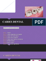 Caries dental: clasificación, factores de riesgo y manejo