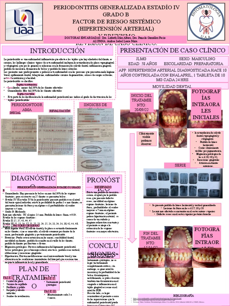 Cartel Periodoncia de Caso Clinico | PDF | Medicina | Causas de la muerte