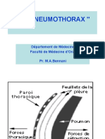 Pneumothorax  