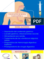 Sonda Nasogastrica