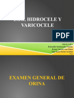 Varicocele