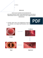 Biologi Sistem Reproduksi Desy Yumni Sabrina (XI MIPA 1-08)