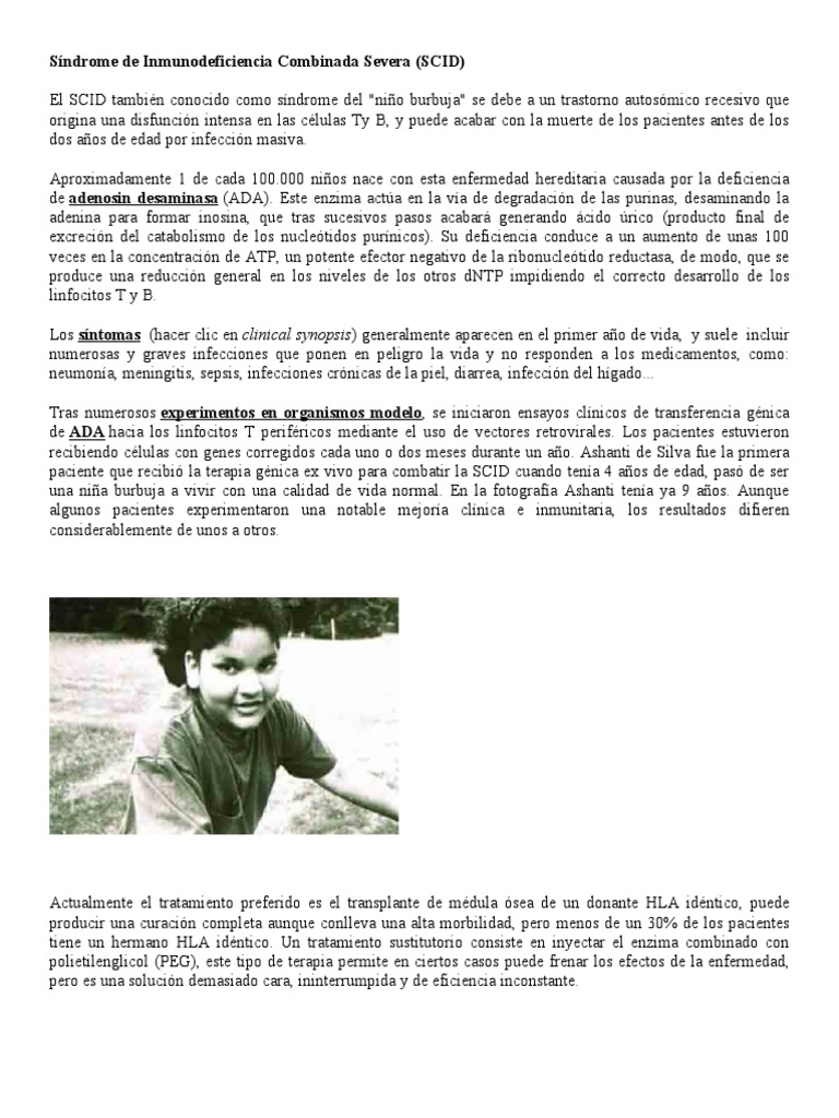 Síndrome de Inmunodeficiencia Combinada Severa PDF Especialidades