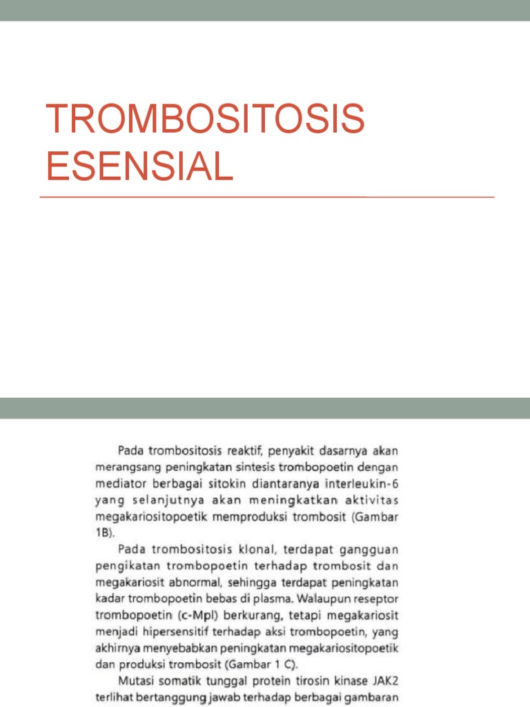Trombositosis Essensial PDF