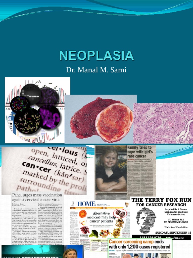 Neoplasia 1 Lecture Bds Pdf Metastasis Neoplasms