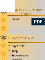 Fungal Infections