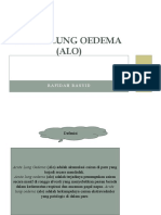 Acute Lung Oedema (Alo) PPT FIDA