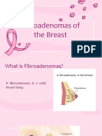 Fibroadenomas: Common Benign Breast Lumps Explained