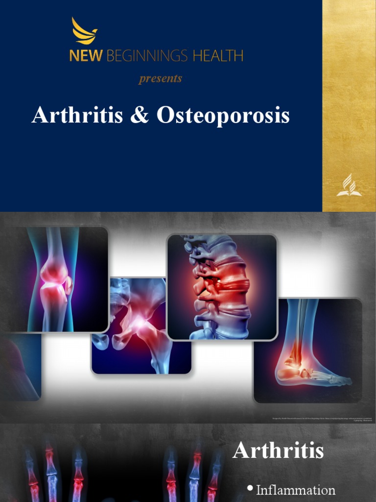 Presents: Arthritis & Osteoporosis | PDF | Osteoporosis | Human ...