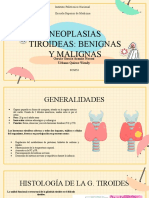 Neoplasias tiroideas: clasificación y características de los carcinomas papilar y folicular