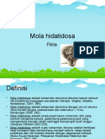 Mola Hidatidosa