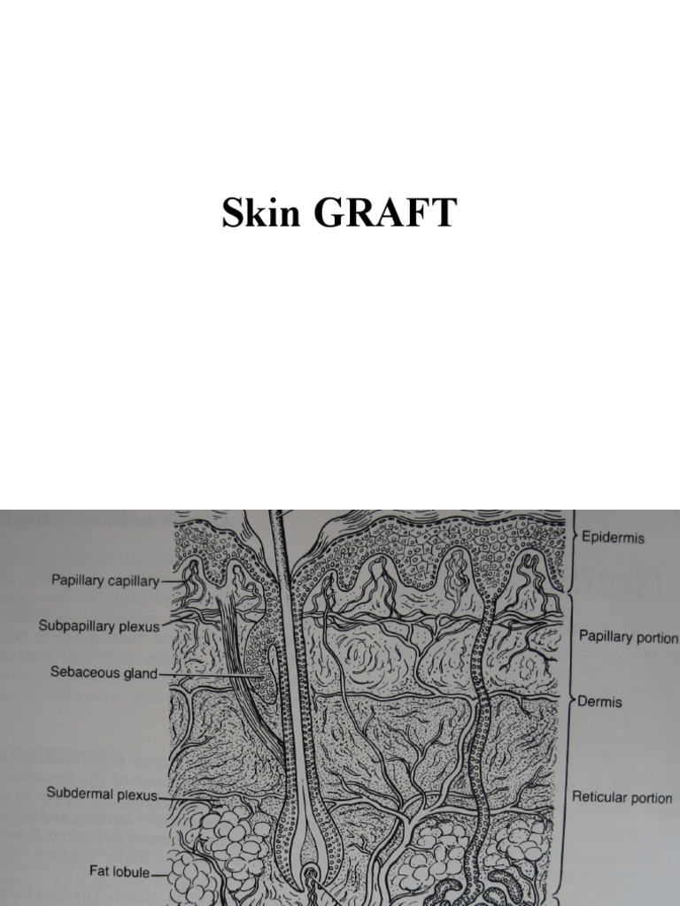 Skin Graft | PDF