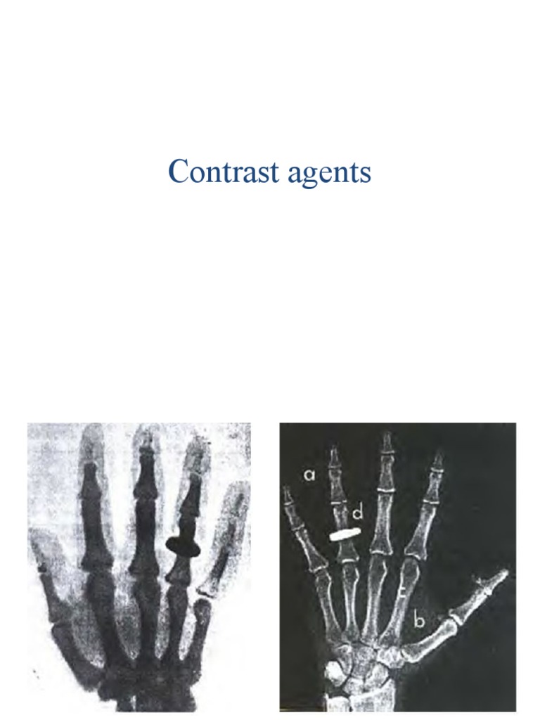 Contrast Media | PDF | Medical Imaging | Medicine
