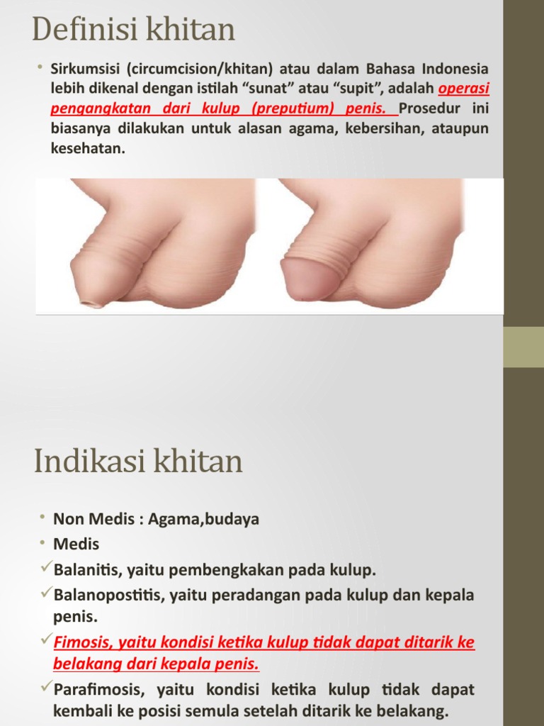 Mushukdagi ikkita sik bilan porno tomosha qiling