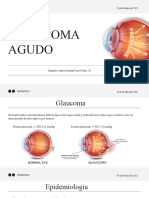Glaucoma Agudo