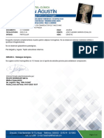 Ecografia de Mama Con Transductor de 7 MHZ o Mas