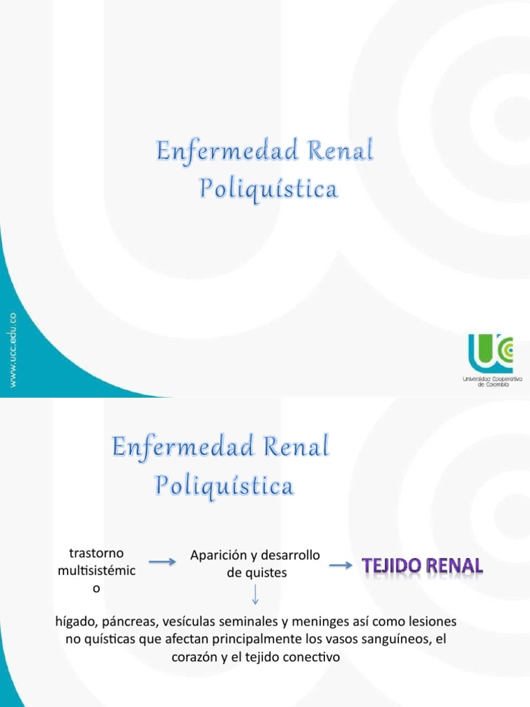 Enfermedad Poliqustica Renal PDF Especialidades Medicas Medicina