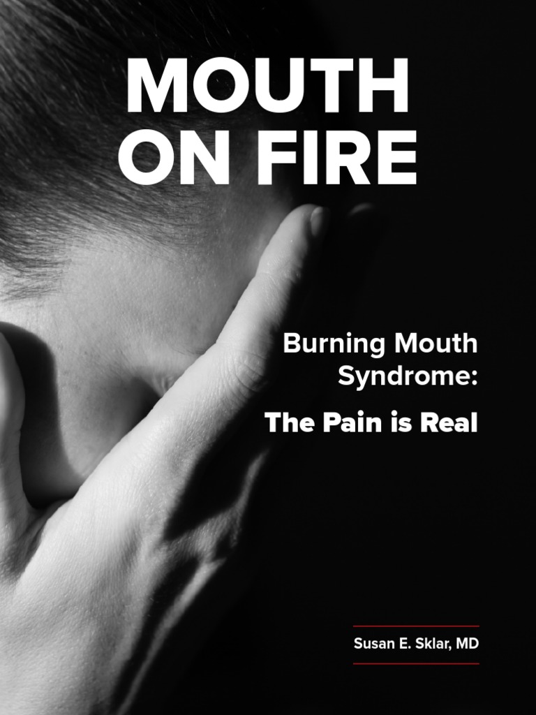 neurontin for burning mouth syndrome