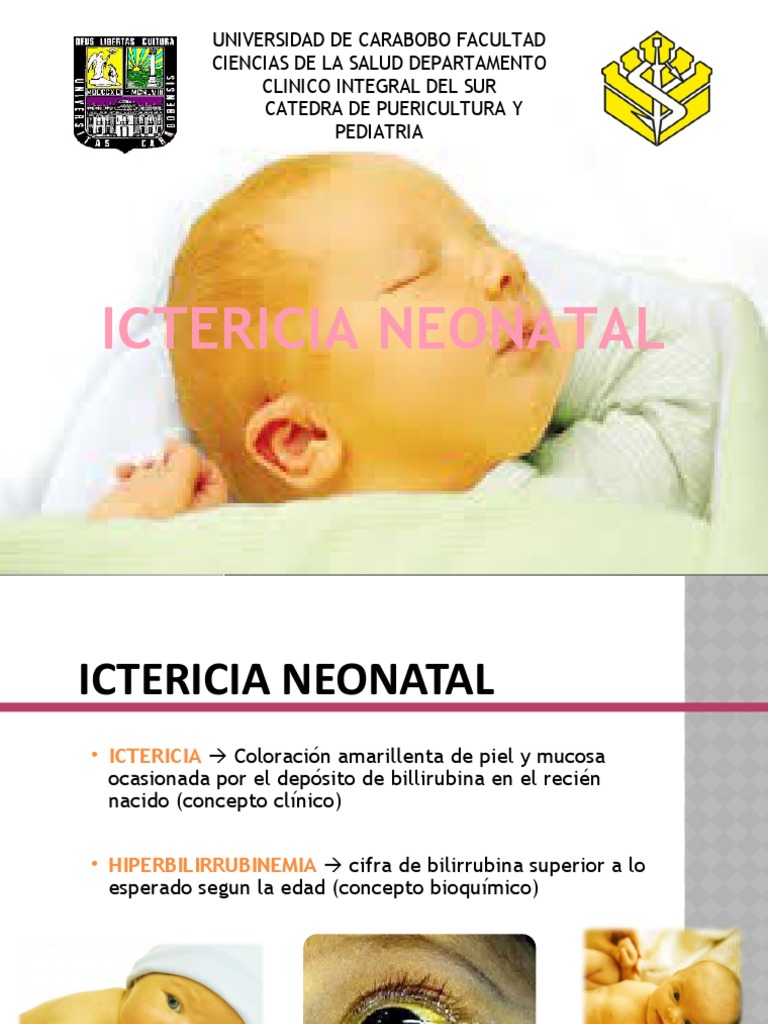 ICTERICIA NEONATAL 2 Rotacion | PDF | Especialidades Medicas | Medicina ...