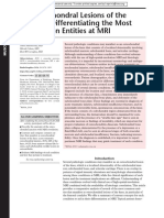 Osteochondral Lesions of The Knee Differentiating The Most Common Entities at MRI ODLICNO