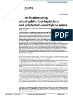 Scleral Fixation Using A Hydrophilic Four Haptic Lens and Polytetrafluoroethylene Suture