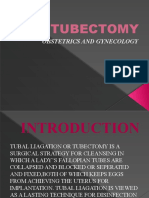 TUBECTOMY