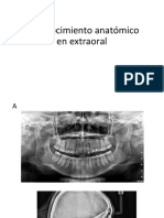 Panoramica y Cefalometrica