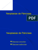 Neoplasias Del Páncreas