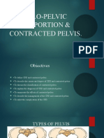 Understanding Cephalo-Pelvic Disproportion & Contracted Pelvis