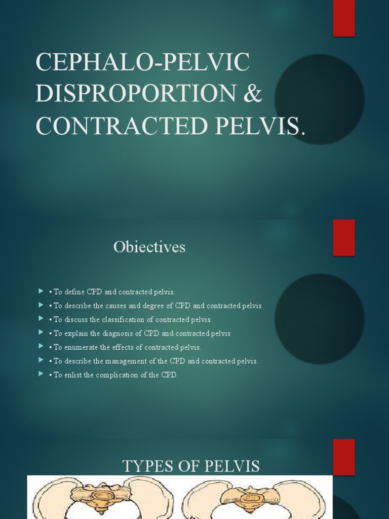 Understanding Contracted Pelvis & CPD | PDF | Childbirth | Pelvis