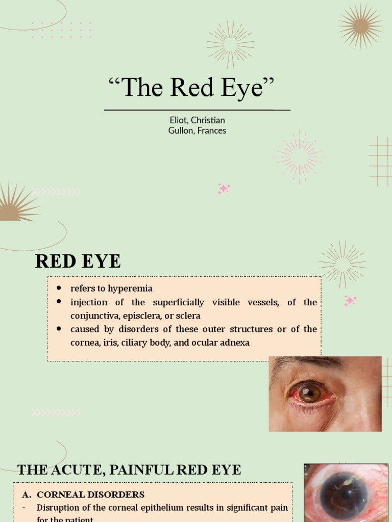 The Red Eye PDF Cornea Medicine