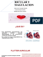 Fibrilación auricular: anticoagulación y riesgo de accidente cerebrovascular