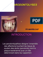 Presentation Les Parodontolyses