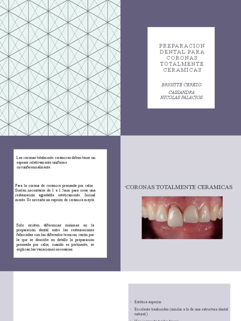 Preparación Dental para Coronas Cerámicas | PDF | Cerámica | Diente